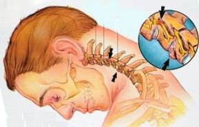 De cervicale afdeling