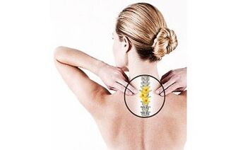 cervicale osteochondrose bij een vrouw